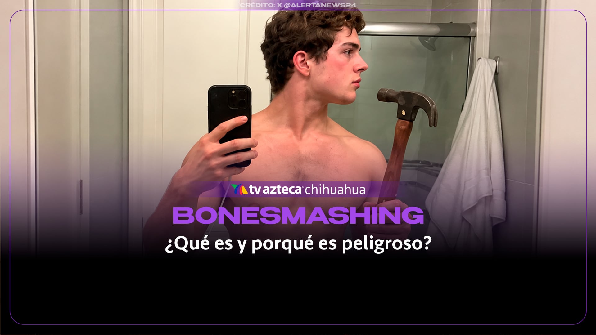 Bonesmashing: la peligrosa tendencia de golpearse la cara para marcar la mandíbula que preocupa a médicos